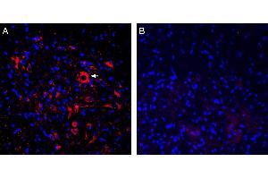 Expression of ASIC2a in rat spinal cord. (ACCN1 antibody  (Intracellular, N-Term))