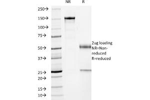 SDS-PAGE (SDS) image for anti-Tumor Protein P53 (TP53) antibody (ABIN6940778)