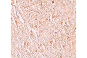 Immunohistochemical staining of human brain cells with PION polyclonal antibody  at 5 ug/mL.