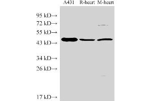 Western Blot analysis of 1)A431, 2)Rat heart, 3)Mouse heart using SERPINB2 Polyclonal Antibody at dilution of 1:1000