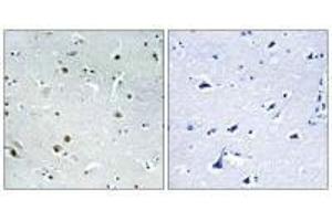 anti-DEAD (Asp-Glu-Ala-Asp) Box Polypeptide 24 (DDX24) antibody
