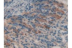Immunohistochemistry (IHC) image for anti-Catalase (CAT) (AA 32-157) antibody (ABIN7437689)