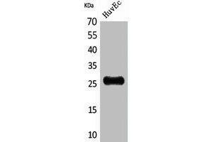 Western Blot analysis of HuvEc cells using CacyBP Polyclonal Antibody. (CACYBP antibody  (C-Term))