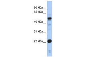 Image no. 1 for anti-Cysteine and Glycine-Rich Protein 1 (CSRP1) (AA 71-120) antibody (ABIN6742467) (CSRP1 antibody  (AA 71-120))