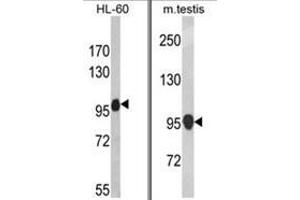 (LEFT) Western blot analysis of NLRP12 Antibody in HL-60 cell line lysates (35ug/lane). (NLRP12 antibody  (C-Term))