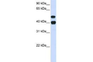 WB Suggested Anti-USP22 Antibody Titration: 0. (USP22 antibody  (N-Term))