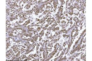 IHC analysis of JHDM3A/JMJD2A/KDM4A using anti-JHDM3A/JMJD2A/KDM4A antibody (ABIN7601534). (KDM4A antibody  (AA 379-1064))