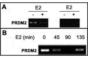 A : Soluble chromatin was prepared from MCF-7 cells not treated or treated with E2 for 45 min. (PRDM2 antibody  (AA 1-347))