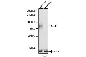 Western blot analysis of extracts of HeLa cells, using CD44 antibody (ABIN6127602, ABIN6138193, ABIN6138195 and ABIN7101398) at 1:1000 dilution. (CD44 antibody  (AA 148-247))