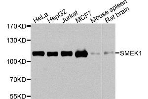 Western blot analysis of extracts of various cell lines, using SMEK1 antibody.