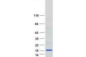 Validation with Western Blot (TRAPPC2L Protein (Myc-DYKDDDDK Tag))