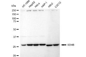Western blotting analysis using SDHB antibody (ABIN7800453).