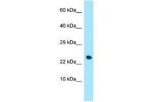 Western Blotting (WB) image for anti-Tumor Necrosis Factor Receptor Superfamily, Member 17 (TNFRSF17) (C-Term) antibody (ABIN2789670)