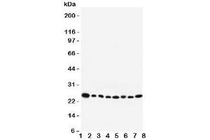 Western blot testing of Rab8 antibody and Lane 1:  rat brain;  2: mouse brain;  3: human placenta;  4: (h) HeLa;  5: (r) PC12;  6: (m) NIH3T3;  7: (h) A431;  8: (h) 293T lysate. (RAB8A antibody  (C-Term))