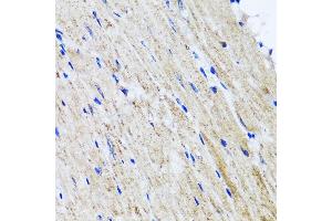 Immunohistochemistry of paraffin-embedded mouse heart using HY antibody  at dilution of 1:100 (40x lens). (HYAL1 antibody  (AA 136-435))