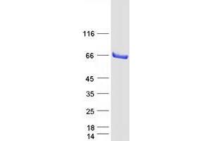 Western Blotting (WB) image for Stromal Membrane Associated Protein 1 (SMAP1) (Transcript Variant 1) protein (Myc-DYKDDDDK Tag) (ABIN2732231)