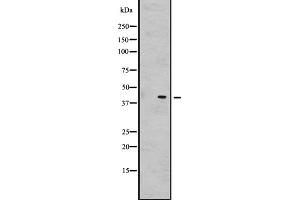 Western blot analysis of GNRHR2 expression in Hela cell lysate,The lane on the left is treated with the antigen-specific peptide. (GNRHR2 antibody)