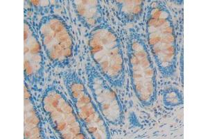 Used in DAB staining on fromalin fixed paraffin- embedded Kidney tissue (SDCBP antibody  (AA 2-298))