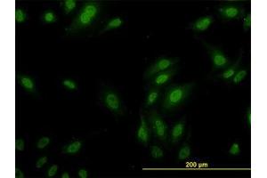 Image no. 3 for anti-Ribosomal Protein L9 (RPL9) (AA 93-192) antibody (ABIN598584) (RPL9 antibody  (AA 93-192))