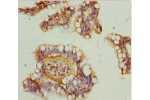 Immunohistochemistry of paraffin-embedded human small intestine tissue using ABIN7160913 at dilution of 1:100 (NDUFA9 antibody  (AA 1-270))