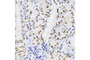 Immunohistochemistry of paraffin-embedded human stomach using XRCC5 Antibody (ABIN5973473) at dilution of 1/100 (40x lens). (XRCC5 antibody)