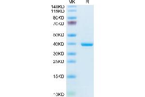 Annexin a1 Protein (AA 1-346) (His tag)