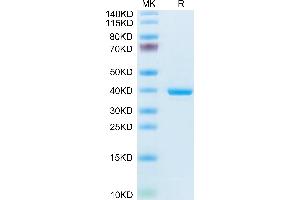 Mouse ANXA1 on Tris-Bis PAGE under reduced condition. (Annexin a1 Protein (AA 1-346) (His tag))