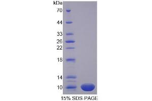 Image no. 1 for Protamine 1 (PRM1) (AA 2-51) protein (His tag) (ABIN6237546)