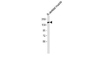 Anti-BCORL1 Antibody (N-term) at 1:500 dilution + Rat skeletal muscle lysate Lysates/proteins at 20 μg per lane.