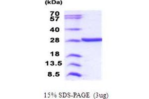 SDS-PAGE (SDS) image for Methyltransferase Like 21D (METTL21D) (AA 1-229) protein (His tag) (ABIN5853997) (Methyltransferase Like 21D (METTL21D) (AA 1-229) protein (His tag))