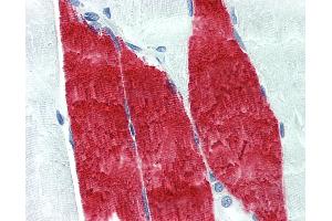 Anti-TNNI / Troponin I Skeletal antibody IHC of human skeletal muscle. (Troponin I antibody)