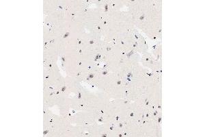 Immunohistochemical analysis of paraffin-embedded human brain tissue using (ABIN6242564 and ABIN6578912) performed on the Leica® BOND RXm. (TNIK antibody  (Ser764))