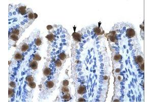Image no. 1 for anti-Zinc Finger Protein 70 (ZNF70) (AA 119-168) antibody (ABIN202542) (ZNF70 antibody  (AA 119-168))