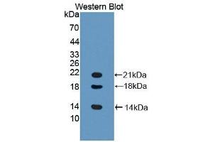 Detection of Recombinant LYAR, Mouse using Polyclonal Antibody to Ly1 Antibody Reactive Homolog (LYAR) (LYAR antibody  (AA 270-388))