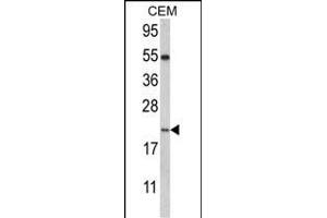 Western blot analysis of NANOS2 Antibody (C-term) (ABIN389197 and ABIN2839360) in CEM cell line lysates (35 μg/lane). (NANOS2 antibody  (C-Term))