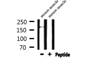 Western blot analysis of extracts from mouse muscle, using MRP6 Antibody. (ABCC6 antibody  (Internal Region))