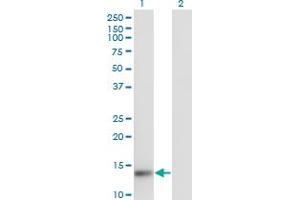 Western Blot analysis of TXNL4A expression in transfected 293T cell line by TXNL4A monoclonal antibody (M01), clone 1C4. (TXNL4A antibody  (AA 1-142))