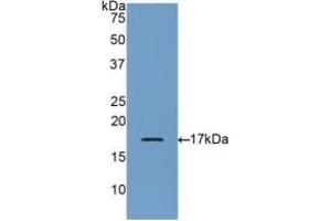 Detection of Recombinant GRN, Human using Polyclonal Antibody to Granulin (GRN) (Granulin antibody  (AA 21-120))