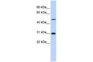 ING3 antibody used at 1 ug/ml to detect target protein. (ING3 antibody  (N-Term))