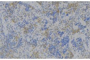 ABIN6272366 at 1/100 staining Human lymph node tissue by IHC-P. (NOX3 antibody  (Internal Region))