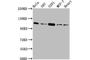 Western Blot Positive WB detected in: Hela whole cell lysate, U87 whole cell lysate, U251 whole cell lysate, MCF-7 whole cell lysate, Rat heart tissue All lanes: ANO2 antibody at 3. (Anoctamin 2 antibody  (AA 1-83))