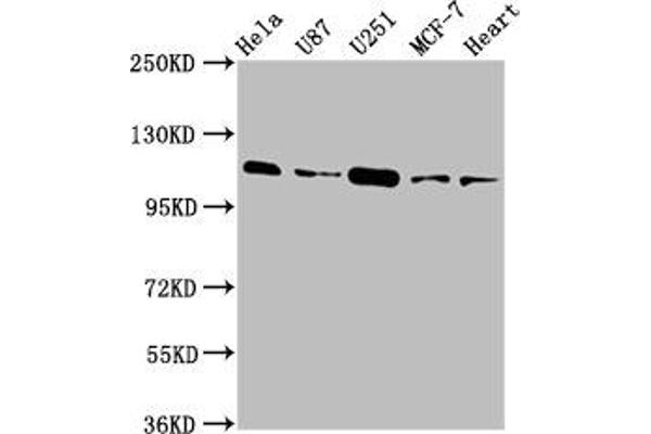 Anoctamin 2 antibody  (AA 1-83)