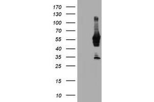 HEK293T cells were transfected with the pCMV6-ENTRY control (Left lane) or pCMV6-ENTRY NMT2 (Right lane) cDNA for 48 hrs and lysed. (NMT2 antibody)