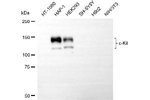 Western blotting analysis using c-kit antibody (ABIN7799335).