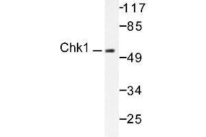 Image no. 1 for anti-Checkpoint Kinase 1 (CHEK1) antibody (ABIN265348) (CHEK1 antibody)