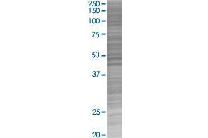 BIRC2 transfected lysate. (BIRC2 293T Cell Transient Overexpression Lysate(Denatured))