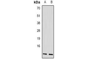 Western blot analysis of AP3-beta-1 expression in SKOV3 (A), mouse liver (B) whole cell lysates.