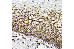 Immunohistochemistry of paraffin-embedded Human normal cervix using CD44 antibody  at dilution of 1:100 (40x lens). (CD44 antibody)