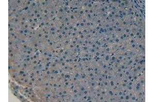 DAB staining on IHC-P; Samples: Human Liver Tissue (COLEC10 antibody  (AA 34-277))