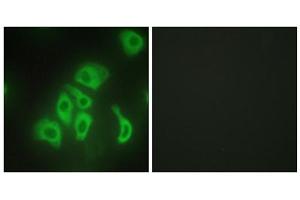 Immunofluorescence analysis of HepG2 cells, using TNF alpha antibody. (TNF alpha antibody  (Internal Region))